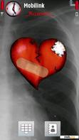 Скачать тему Chest X Ray