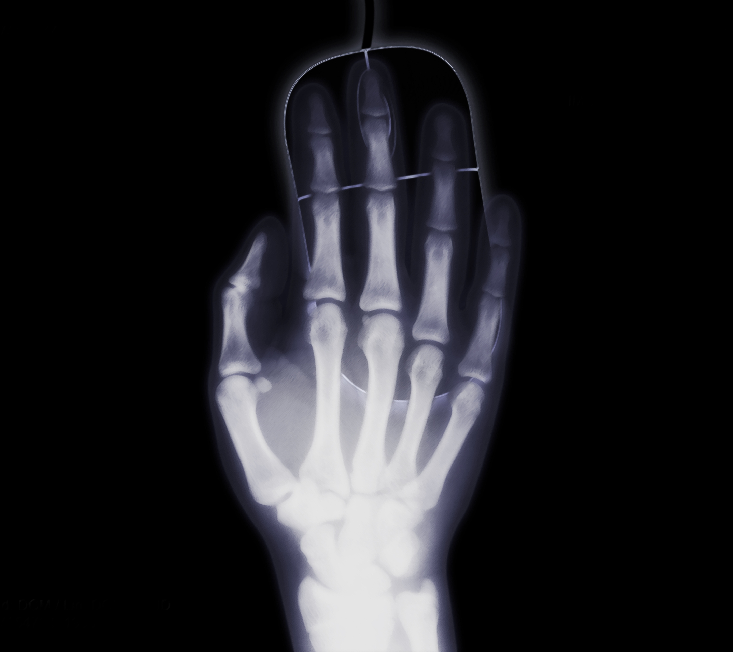 Download mobile wallpaper Hand, X Ray, Photography, Bones, Humor, Minimalist for free.