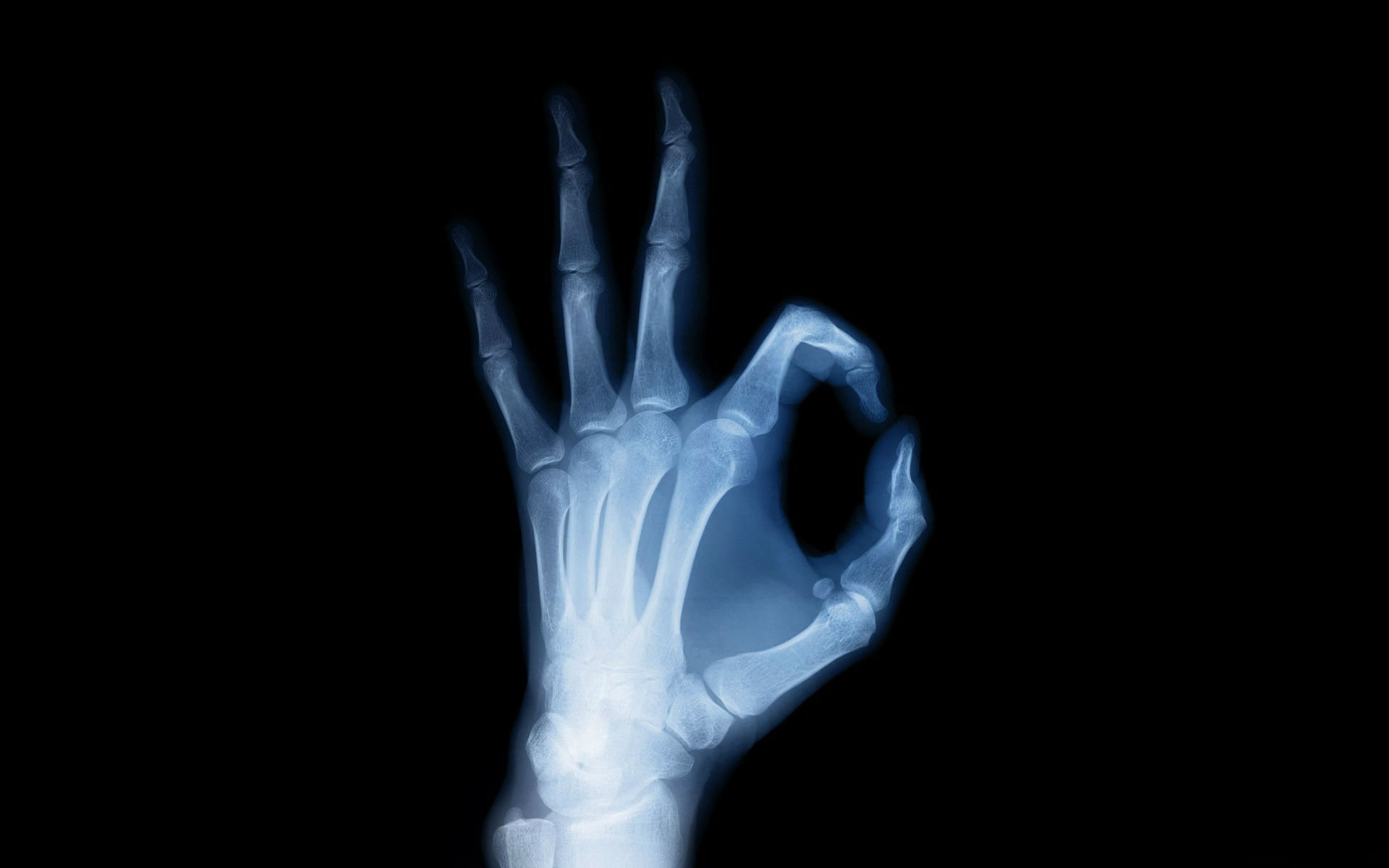 photography, x ray, anatomy, hand, x ray vision